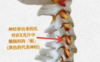 非物质文化遗产 骨刺（骨刺能不能申请非物质文化遗产？）