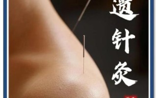 包头非物质文化遗产针灸（包头非遗针灸哪几招治未病最常用）