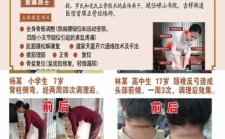 非物质文化遗产循经正骨（非物质文化遗产循经正骨入门指南）