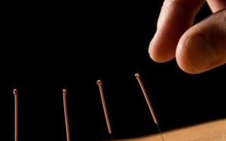 针灸非物质文化遗产（针灸为什么被列入非遗）