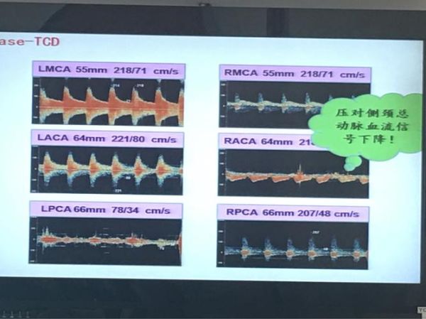 tcd量子计算与技术（TCD量子计算技术入门指南）-第2张图片-八三百科