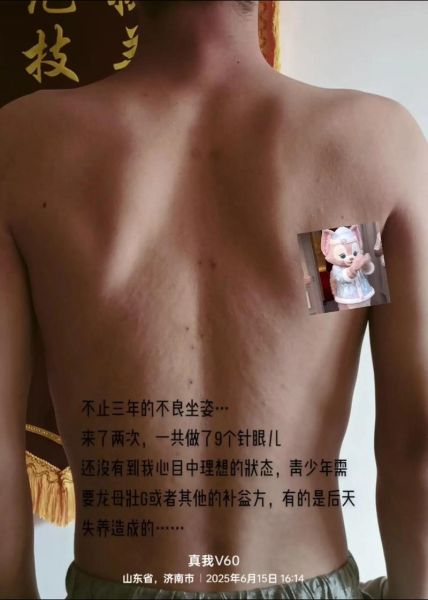 挑羊毛疔非物质文化遗产(挑羊毛疔是国家级非遗吗)-第1张图片-八三百科 挑羊毛疔非物质文化遗产(挑羊毛疔是国家级非遗吗)-第1张图片-八三百科