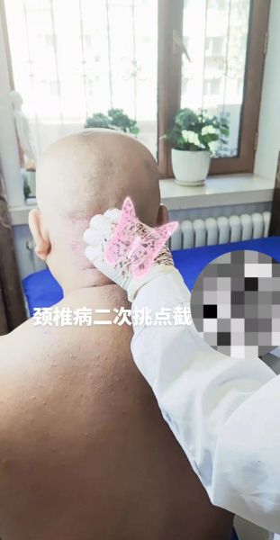 颈椎非物质文化遗产（颈椎非遗疗法有哪些值得新手尝试）-第1张图片-八三百科