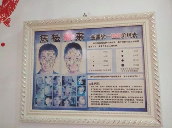 非物质文化遗产点痣（非物质文化遗产点痣合法吗）-第2张图片-八三百科