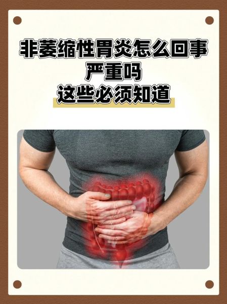 非物质文化遗产胃炎（非物质文化遗产胃炎到底是什么病）-第1张图片-八三百科