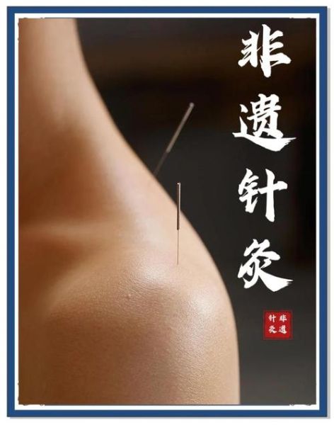 包头非物质文化遗产针灸(包头非遗针灸哪几招治未病最常用)-第1张图片-八三百科 包头非物质文化遗产针灸(包头非遗针灸哪几招治未病最常用)-第1张图片-八三百科