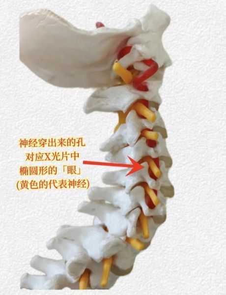 非物质文化遗产 骨刺（骨刺能不能申请非物质文化遗产？）-第1张图片-八三百科