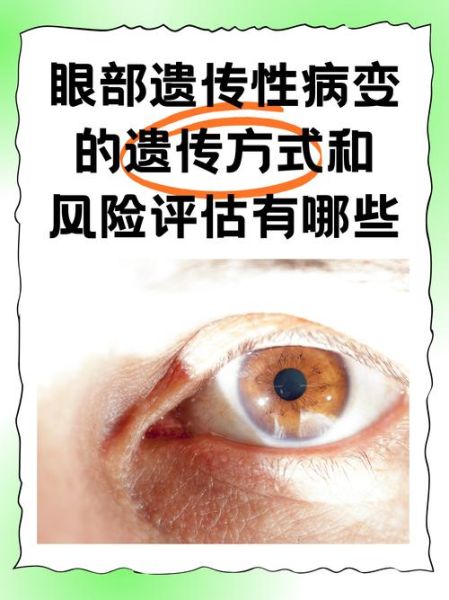 非物质文化遗产马氏眼科(非物质文化遗产马氏眼科治疗近视是真的吗)-第3张图片-八三百科 非物质文化遗产马氏眼科(非物质文化遗产马氏眼科治疗近视是真的吗)-第3张图片-八三百科